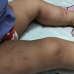 सहायिका ने बच्ची को थप्पड़ और मुक्के मरे, फिर दीवार में फेंका: 15 माह की मासूम पर बर्बरता का CCTV फुटेज सामने आया, मां को जांघ पर निशान देखकर हुआ था शक; डे-केयर संचालिका और सहायिका पर केस दर्ज!