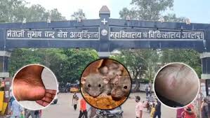 Read more about the article जबलपुर मेडिकल कॉलेज में बड़ा लापरवाही कांड: मरीजों के पैर चूहों ने कुतरे, सफाई कंपनी पर 50 हजार जुर्माना